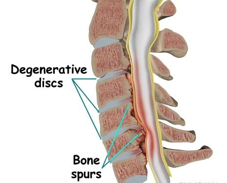 Risks and injuries of neck training